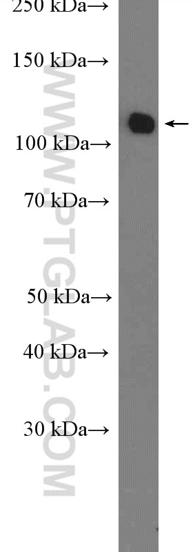 Western Blot (WB) analysis of PC-3 cells using RBM5 Polyclonal antibody (19930-1-AP)