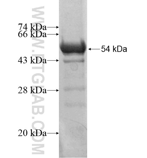 RBM5 fusion protein Ag14029 SDS-PAGE RBM5 fusion protein Ag14029 SDS-PAGE