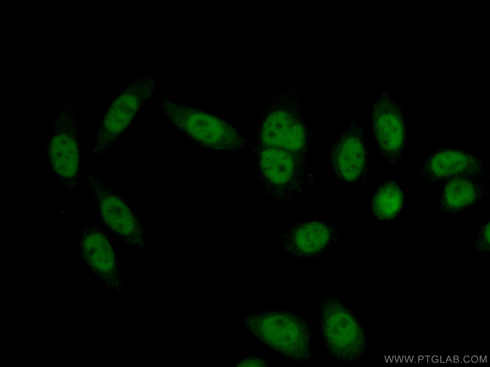 Immunofluorescence (IF) / fluorescent staining of HeLa cells using RBM6 Polyclonal antibody (14360-1-AP)