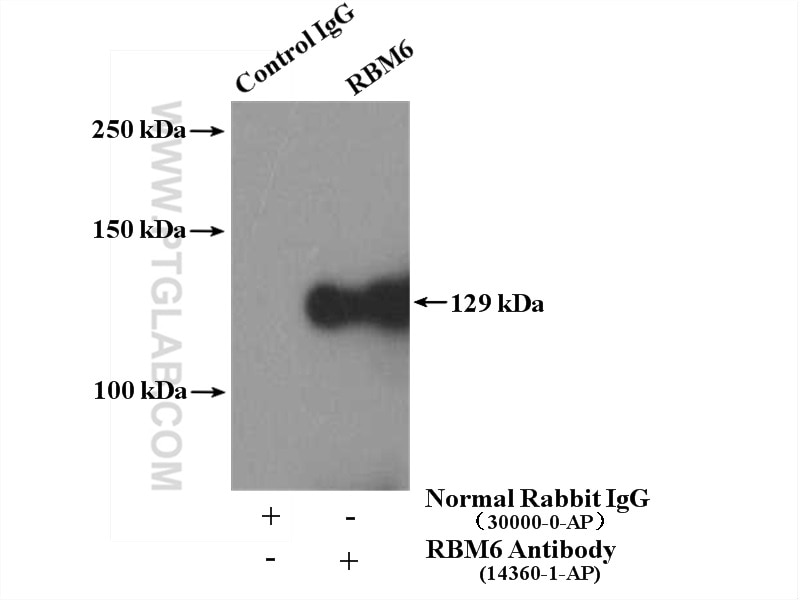 Immunoprecipitation (IP) experiment of HeLa cells using RBM6 Polyclonal antibody (14360-1-AP)