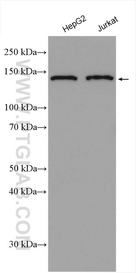 Western Blot (WB) analysis of various lysates using RBM6 Polyclonal antibody (14360-1-AP)