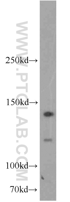 Western Blot (WB) analysis of mouse spleen tissue using RBM6 Polyclonal antibody (14360-1-AP)