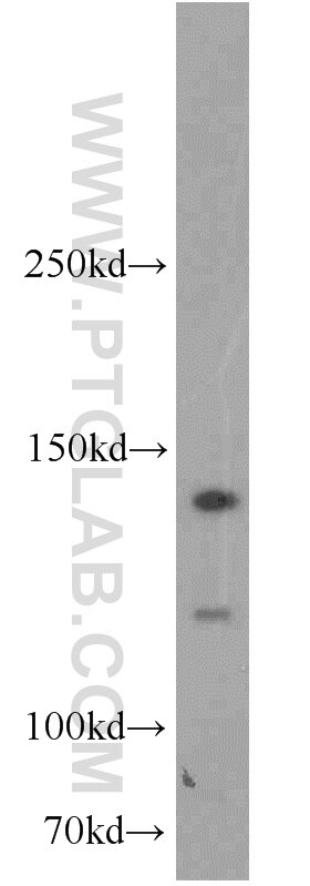 Western Blot (WB) analysis of mouse spleen tissue using RBM6 Polyclonal antibody (14360-1-AP)