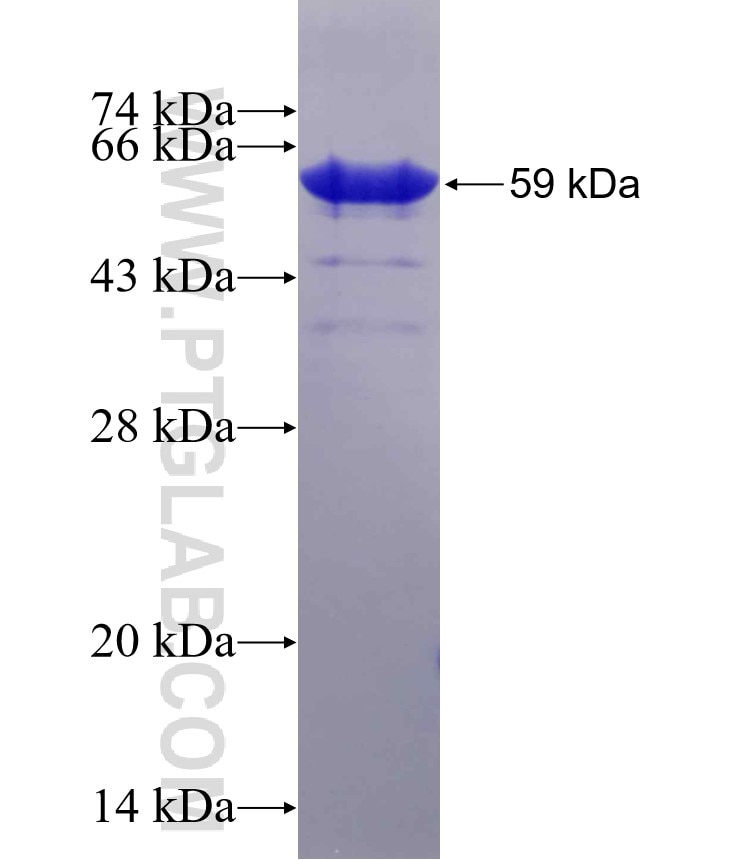 RBM6 fusion protein Ag5743 SDS-PAGE