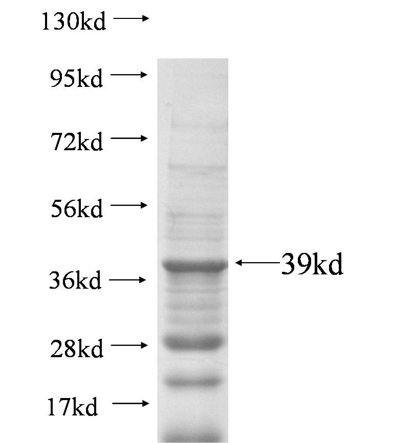 RBM6 fusion protein Ag5905 SDS-PAGE