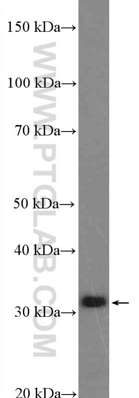 Western Blot (WB) analysis of HeLa cells using RBM7 Polyclonal antibody (21896-1-AP)