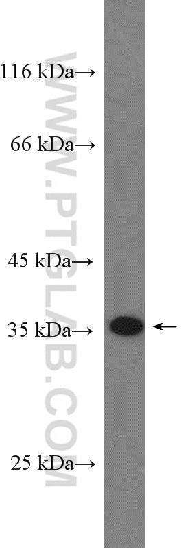 Western Blot (WB) analysis of HepG2 cells using RBM7 Polyclonal antibody (21896-1-AP)