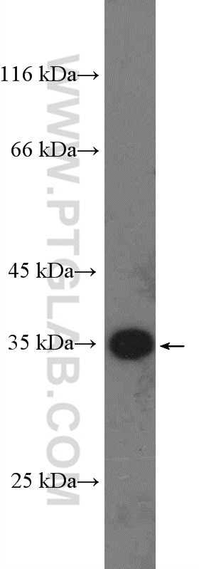 Western Blot (WB) analysis of HeLa cells using RBM7 Polyclonal antibody (21896-1-AP)