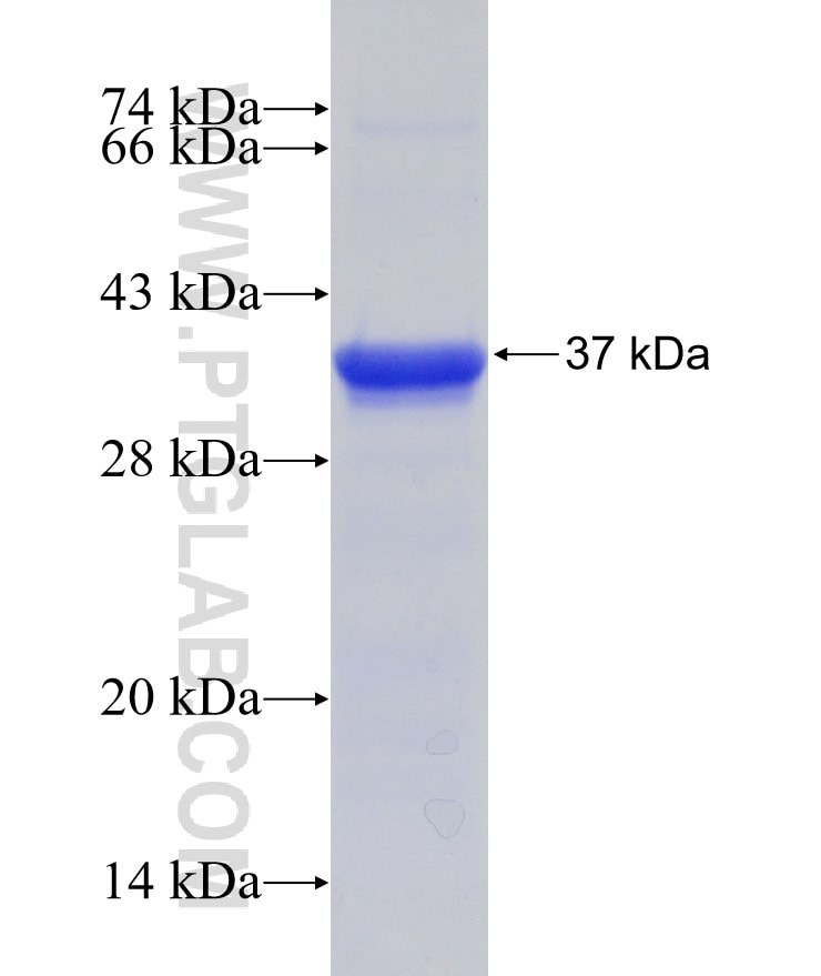 RBM7 fusion protein Ag11106 SDS-PAGE
