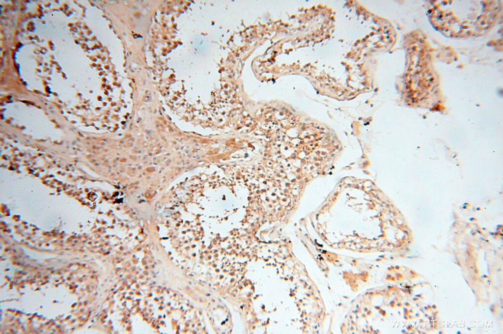 IHC staining of human testis using 14958-1-AP