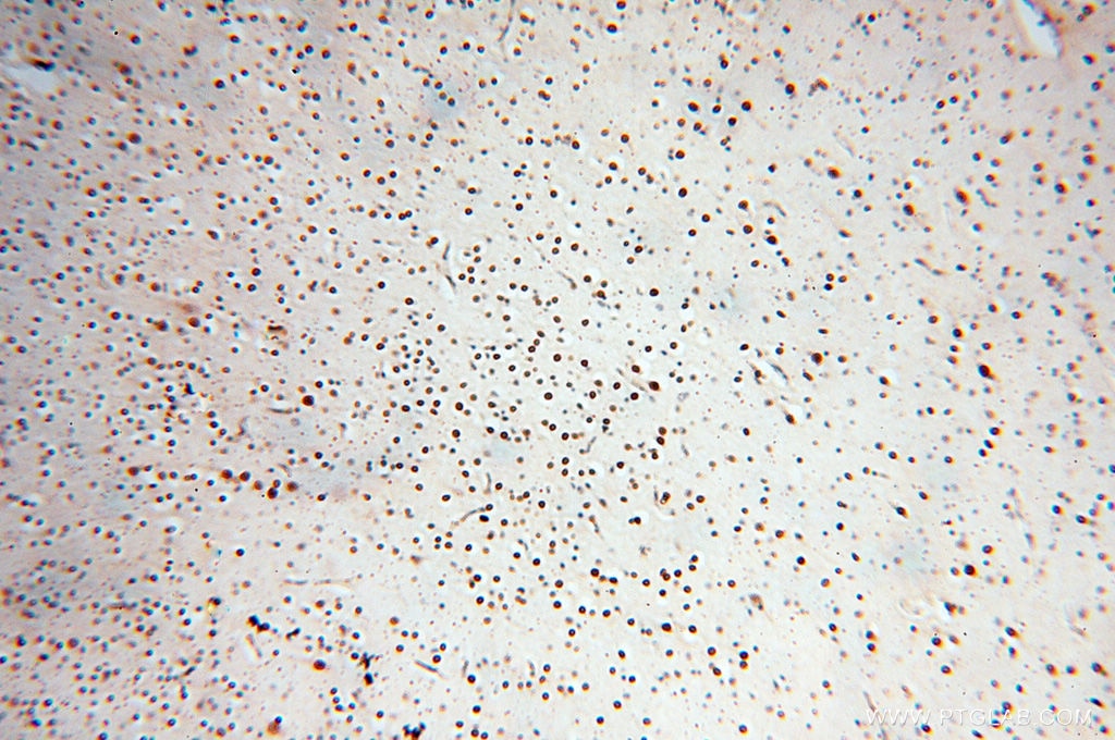 Immunohistochemistry (IHC) staining of human brain tissue using RBM8A,Y14 Polyclonal antibody (14958-1-AP)