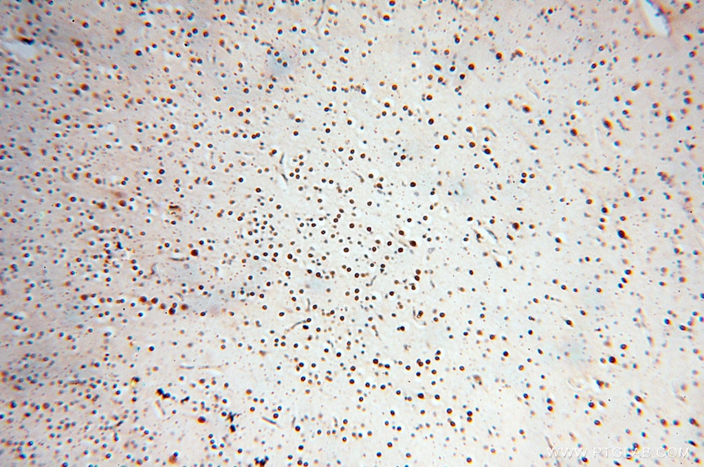 Immunohistochemistry (IHC) staining of human brain tissue using RBM8A,Y14 Polyclonal antibody (14958-1-AP)