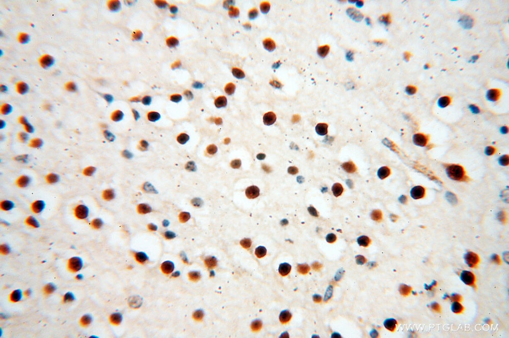 Immunohistochemistry (IHC) staining of human brain tissue using RBM8A,Y14 Polyclonal antibody (14958-1-AP)