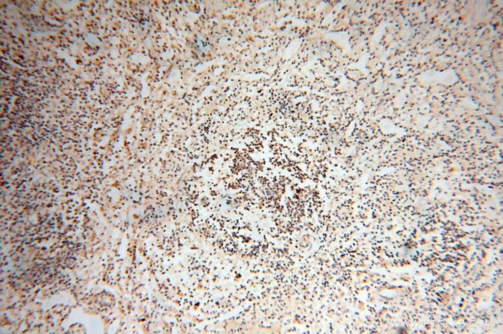 Immunohistochemistry (IHC) staining of human spleen tissue using RBM8A,Y14 Polyclonal antibody (14958-1-AP)