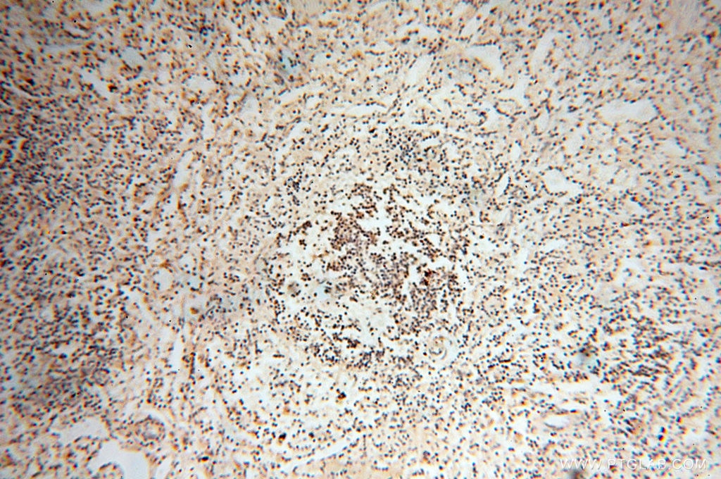 IHC staining of human spleen using 14958-1-AP