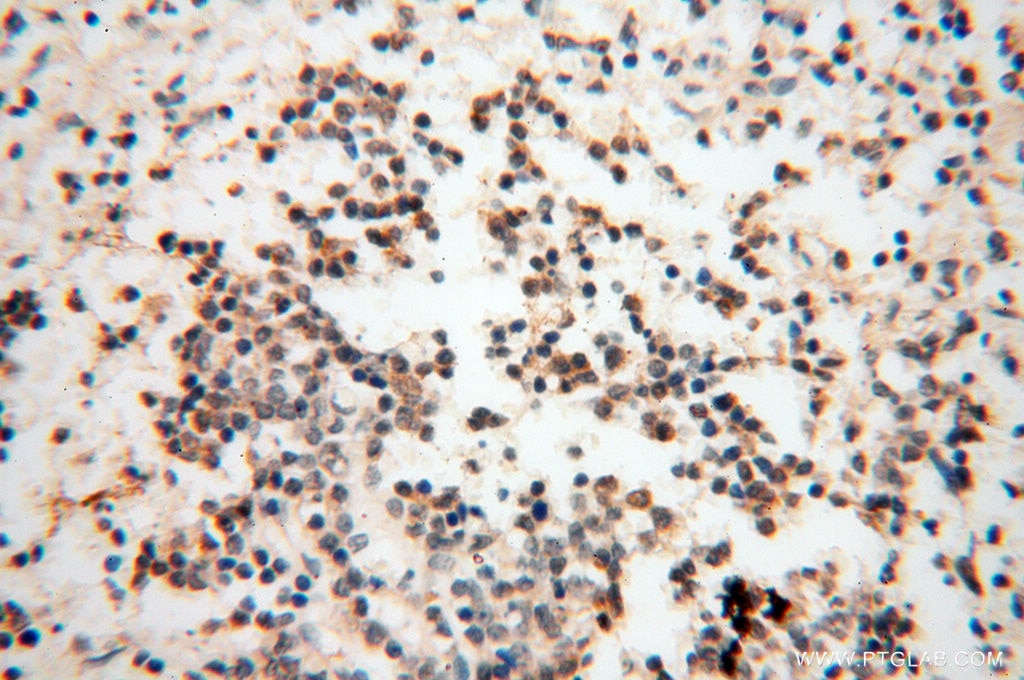 Immunohistochemistry (IHC) staining of human spleen tissue using RBM8A,Y14 Polyclonal antibody (14958-1-AP)