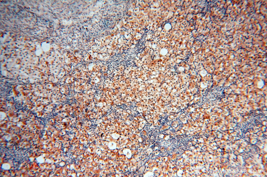 Immunohistochemistry (IHC) staining of human ovary tissue using RBM8A,Y14 Polyclonal antibody (14958-1-AP)