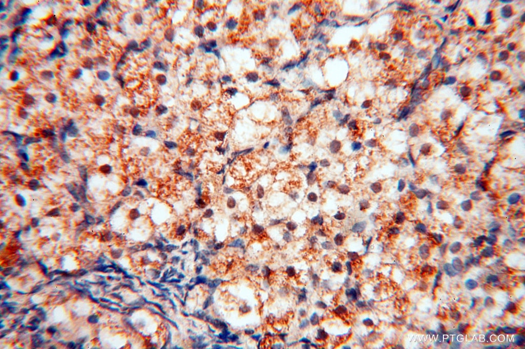 Immunohistochemistry (IHC) staining of human ovary tissue using RBM8A,Y14 Polyclonal antibody (14958-1-AP)