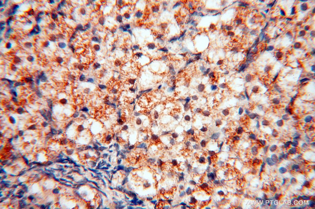 IHC staining of human ovary using 14958-1-AP