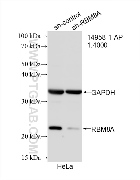 WB analysis of HeLa using 14958-1-AP