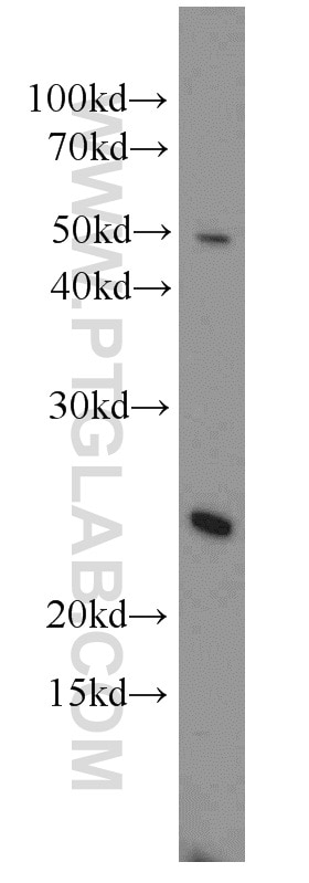 Western Blot (WB) analysis of Jurkat cells using RBM8A,Y14 Polyclonal antibody (14958-1-AP)