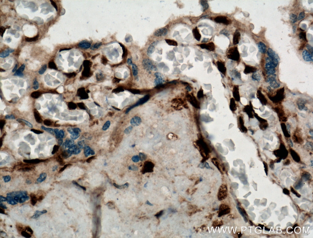 Immunohistochemistry (IHC) staining of human placenta tissue using FOX2/RBM9 Polyclonal antibody (12498-1-AP)