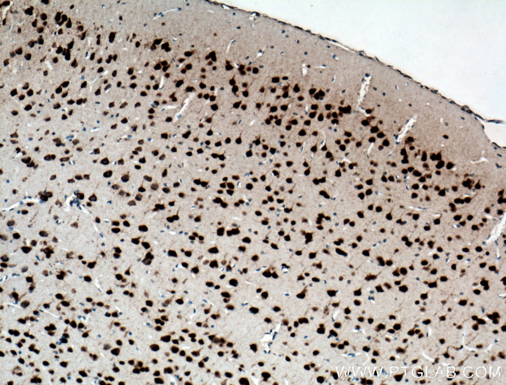 Immunohistochemistry (IHC) staining of mouse brain tissue using FOX2/RBM9 Polyclonal antibody (12498-1-AP)