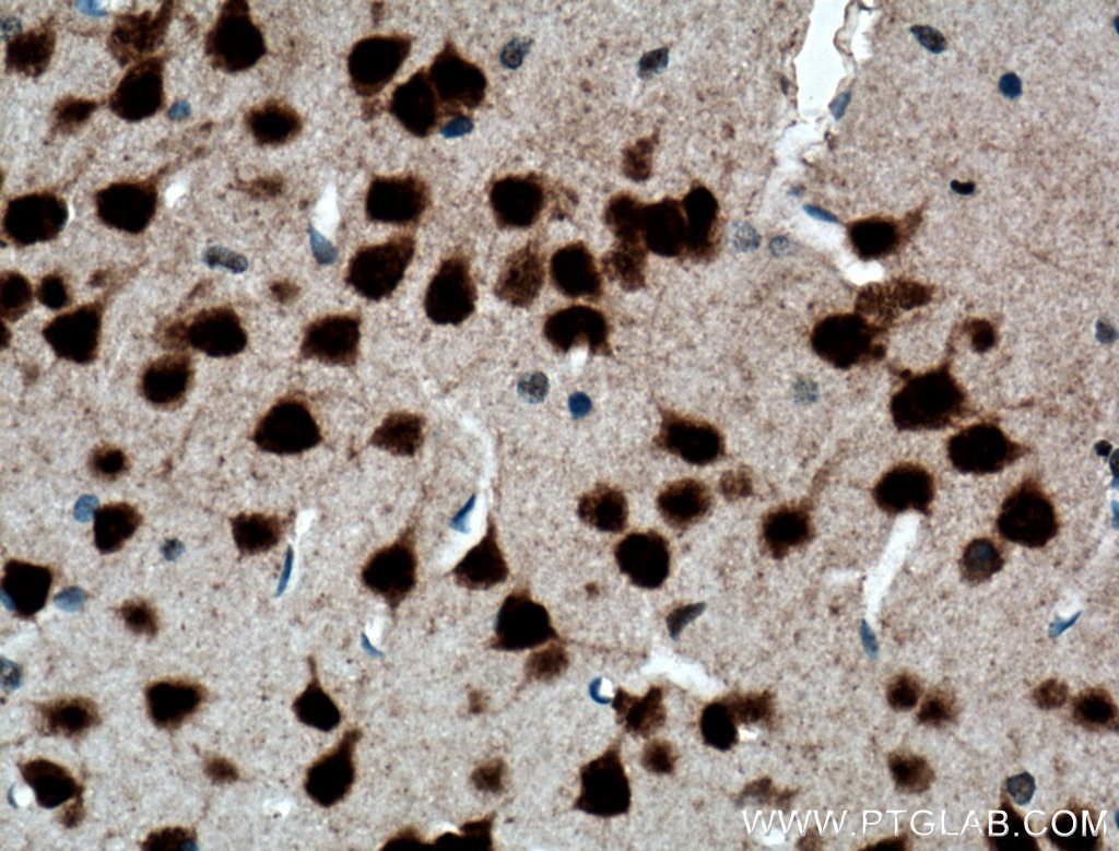 Immunohistochemistry (IHC) staining of mouse brain tissue using FOX2/RBM9 Polyclonal antibody (12498-1-AP)