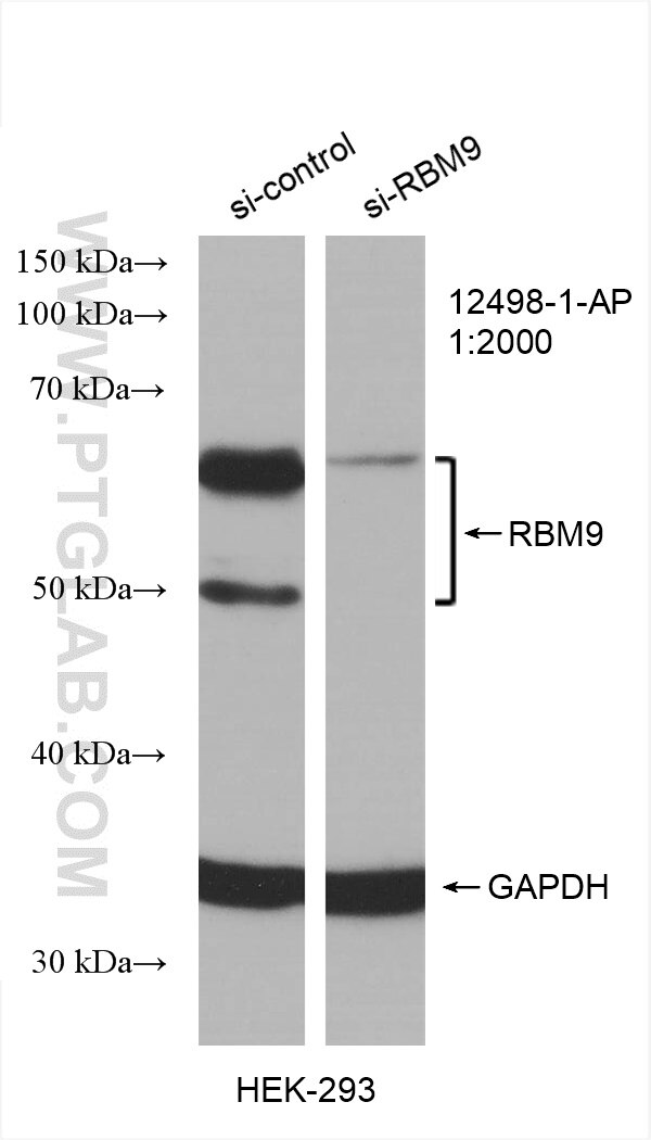 Western Blot (WB) analysis of various lysates using FOX2/RBM9 Polyclonal antibody (12498-1-AP)