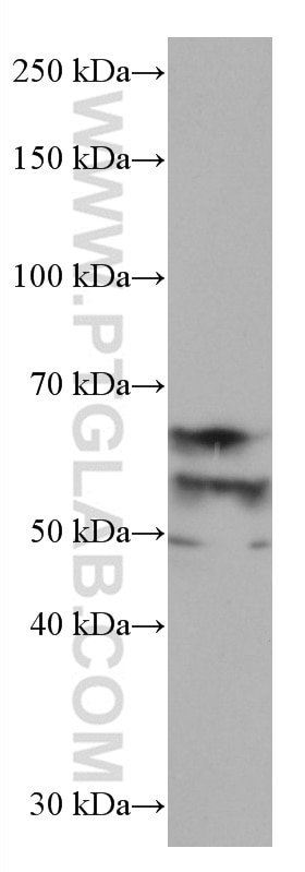 Western Blot (WB) analysis of fetal human brain tissue using FOX2/RBM9 Monoclonal antibody (66976-1-Ig)