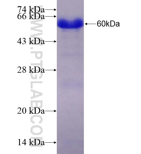 RBM9 fusion protein Ag28336 SDS-PAGE