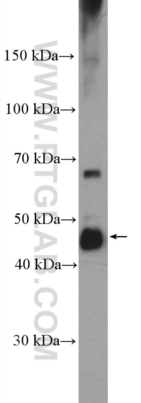 WB analysis of HeLa using 11061-2-AP