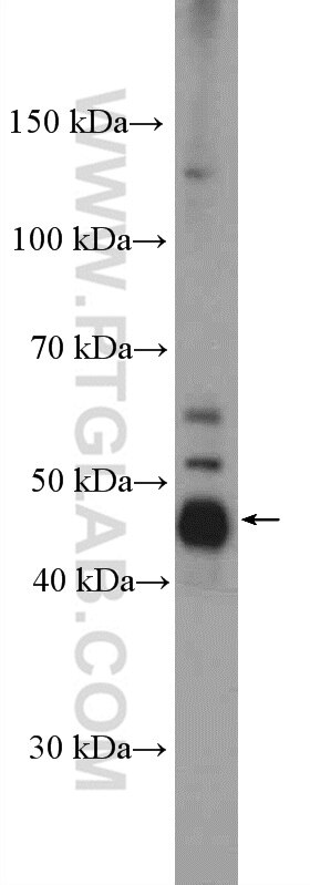 Western Blot (WB) analysis of HeLa cells using RBMS1 Polyclonal antibody (11061-2-AP)