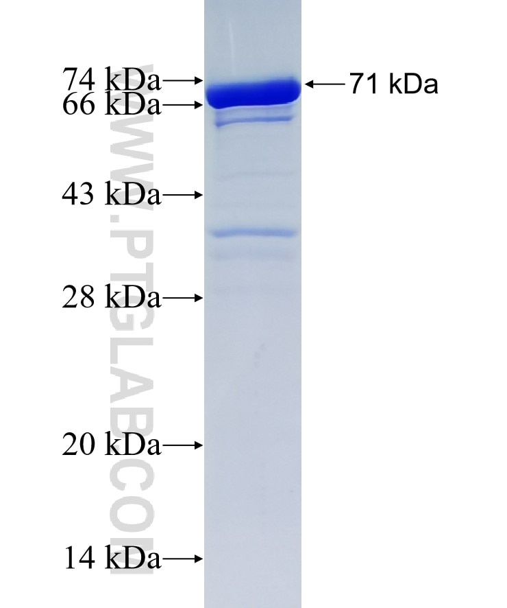 RBMS1 fusion protein Ag1493 SDS-PAGE
