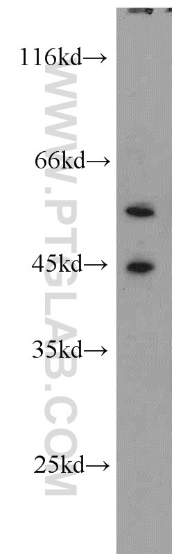 Western Blot (WB) analysis of HeLa cells using RBMS2 Polyclonal antibody (13166-1-AP)