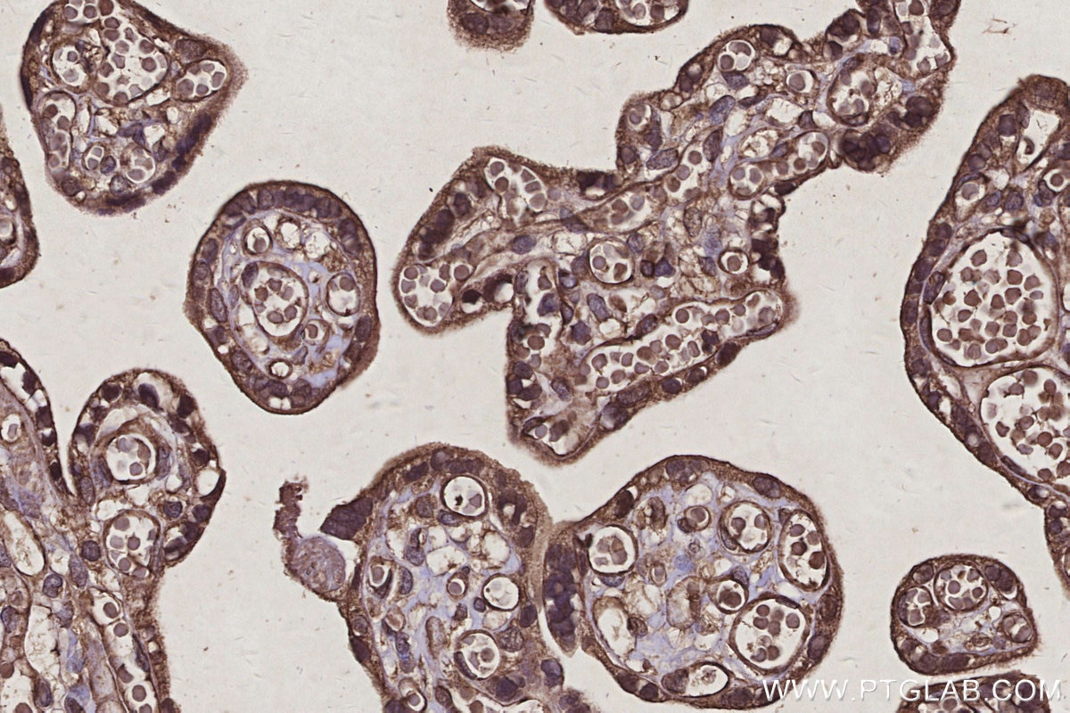 IHC staining of human placenta using 67395-1-Ig Immunohistochemistry (IHC) staining of human placenta tissue using RBMS2 Monoclonal antibody (67395-1-Ig)