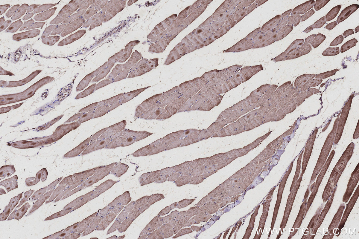 IHC staining of mouse skeletal muscle using 67395-1-Ig Immunohistochemistry (IHC) staining of mouse skeletal muscle tissue using RBMS2 Monoclonal antibody (67395-1-Ig)