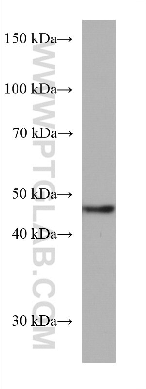 WB analysis of LNCaP using 67395-1-Ig