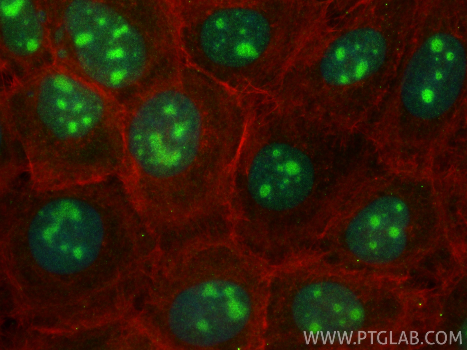 Immunofluorescence (IF) / fluorescent staining of A431 cells using RBMXL2 Polyclonal antibody (27987-1-AP)