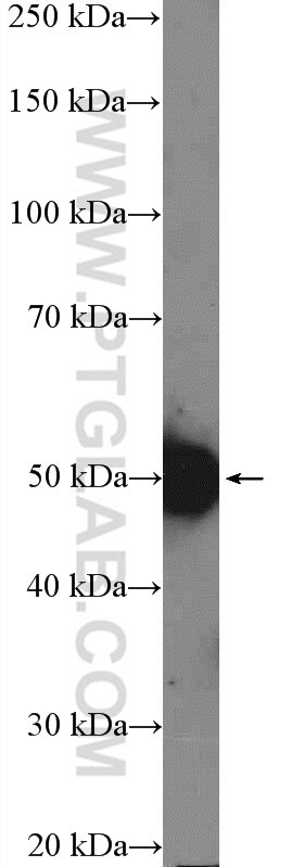 Western Blot (WB) analysis of COLO 320 cells using RBMY1A1 Polyclonal antibody (14239-1-AP)