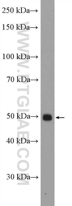 Western Blot (WB) analysis of COLO 320 cells using RBMY1A1 Polyclonal antibody (14239-1-AP)