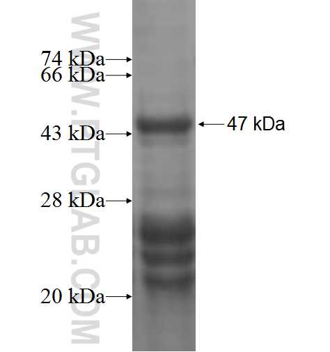 RBMY1A1 fusion protein Ag5493 SDS-PAGE