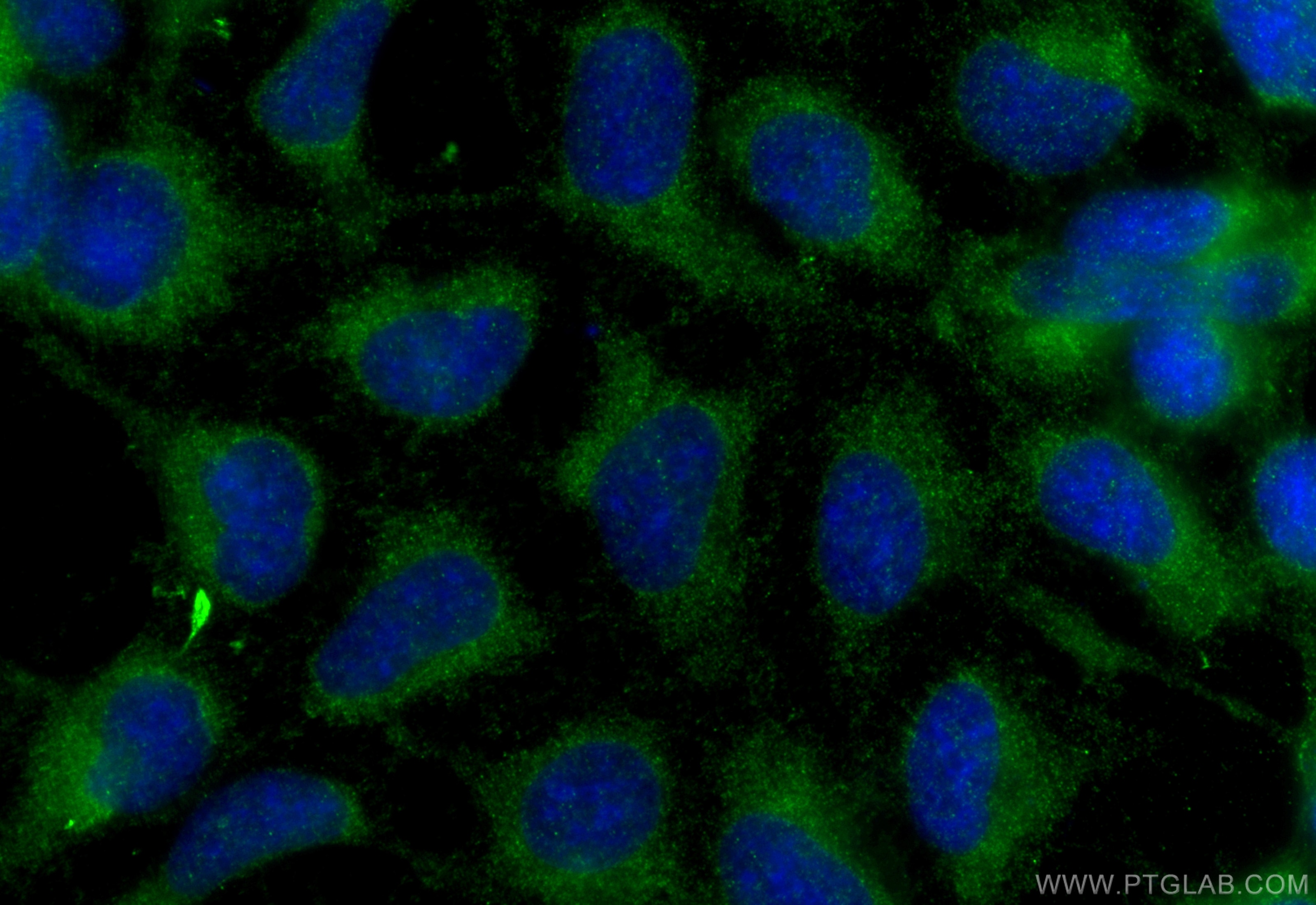 Immunofluorescence (IF) / fluorescent staining of HEK-293 cells using RBP1 Polyclonal antibody (22683-1-AP)