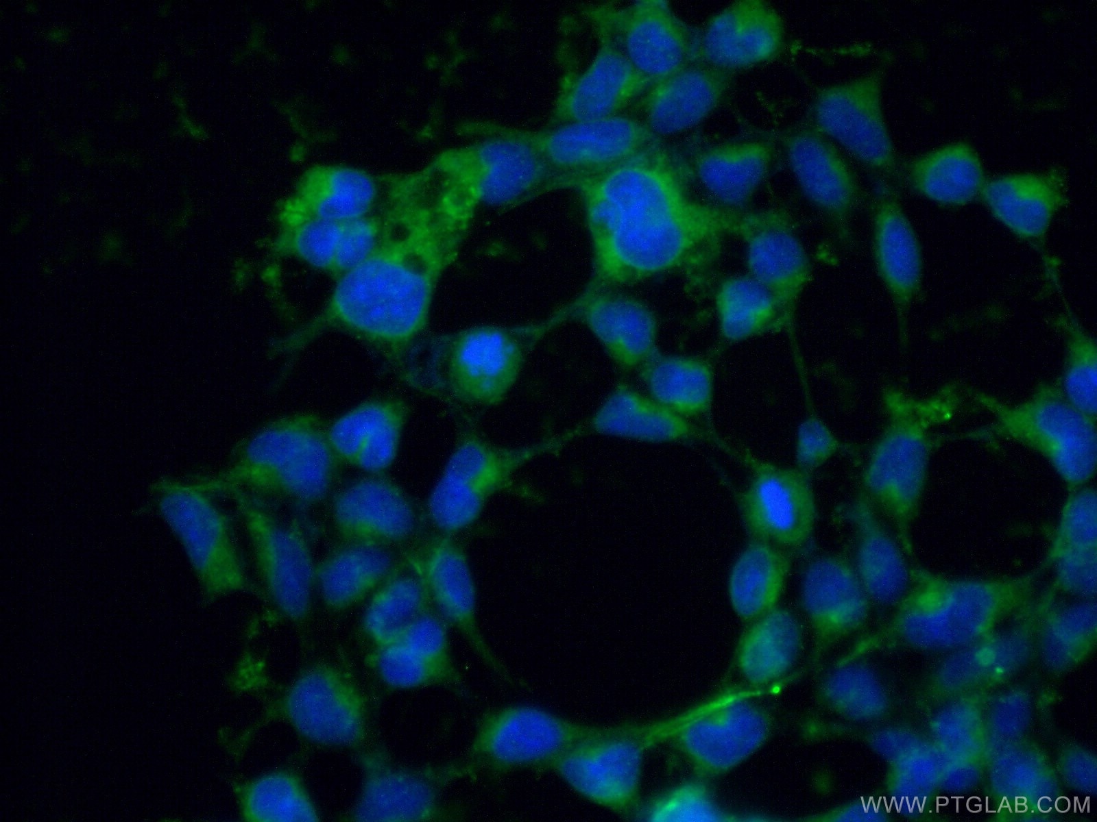 Immunofluorescence (IF) / fluorescent staining of HEK-293 cells using RBP1 Polyclonal antibody (22683-1-AP)