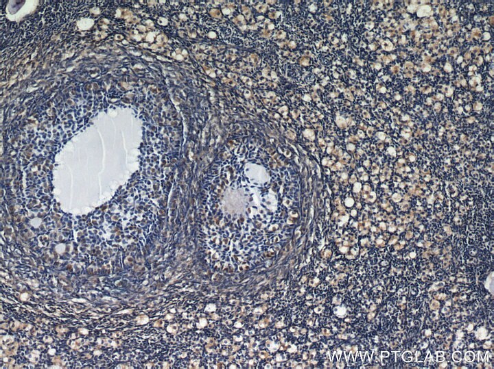 IHC staining of human ovary using 22683-1-AP