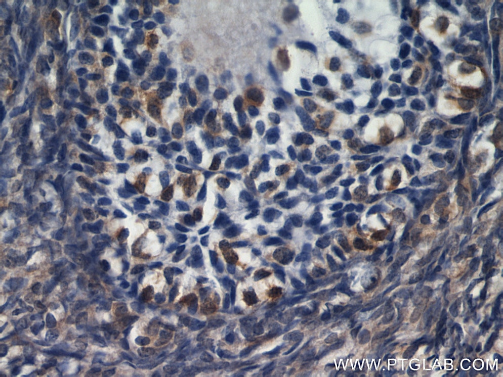 Immunohistochemistry (IHC) staining of human ovary tissue using RBP1 Polyclonal antibody (22683-1-AP)