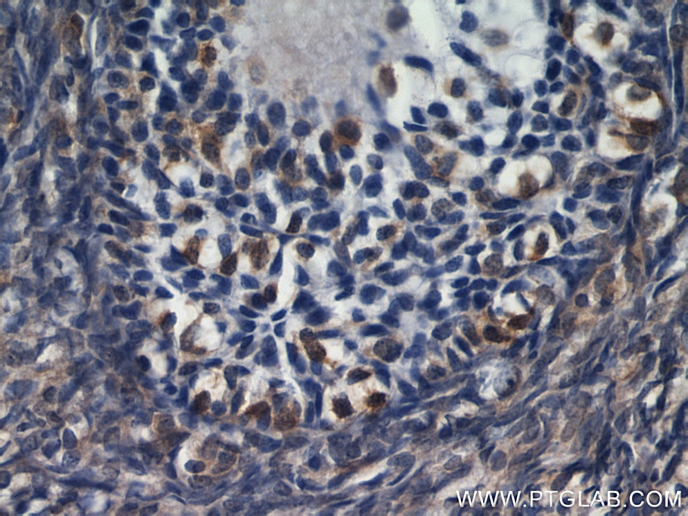 IHC staining of human ovary using 22683-1-AP