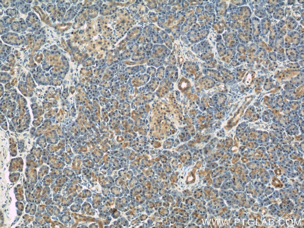 Immunohistochemistry (IHC) staining of human pancreas tissue using RBP1 Polyclonal antibody (22683-1-AP)