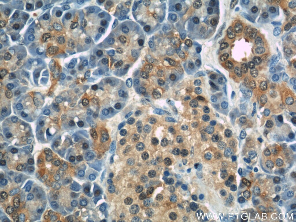 Immunohistochemistry (IHC) staining of human pancreas tissue using RBP1 Polyclonal antibody (22683-1-AP)