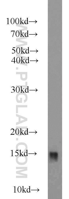 Western Blot (WB) analysis of HEK-293 cells using RBP1 Polyclonal antibody (22683-1-AP)